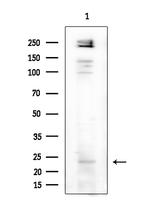 MED28 Polyclonal Antibody