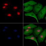 MED29 Polyclonal Antibody