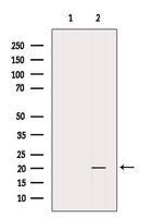 MED30 Polyclonal Antibody