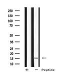 MED9 Polyclonal Antibody