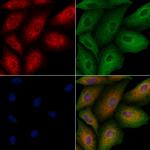 IMMP2L Polyclonal Antibody