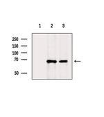 SLC16A9 Polyclonal Antibody