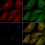 MUC6 Polyclonal Antibody