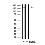 ABCC6 Antibody in Western Blot (WB)
