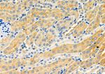 ABCC6 Polyclonal Antibody