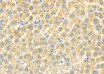 ABCC6 Antibody in Immunohistochemistry (Paraffin) (IHC (P))