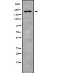 MYH8 Polyclonal Antibody