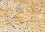 MYO6 Polyclonal Antibody
