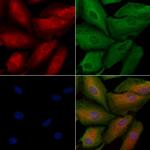 MYO16 Polyclonal Antibody