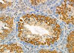 MYO16 Antibody in Immunohistochemistry (Paraffin) (IHC (P))