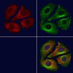 NNT Polyclonal Antibody