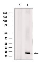 NDUFA5 Polyclonal Antibody