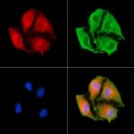 NDUFB3 Polyclonal Antibody