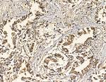 NDUFB3 Antibody in Immunohistochemistry (Paraffin) (IHC (P))