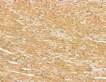 NDUFB3 Antibody in Immunohistochemistry (Paraffin) (IHC (P))
