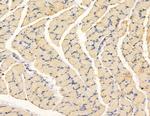 NDUFB3 Antibody in Immunohistochemistry (Paraffin) (IHC (P))