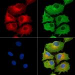 NDUFB5 Polyclonal Antibody