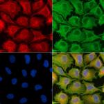 NDUFB7 Polyclonal Antibody