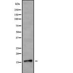 NDUFB7 Antibody in Western Blot (WB)