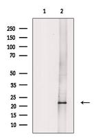 NDUFB8 Polyclonal Antibody