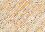 NDUFC1 Antibody in Immunohistochemistry (Paraffin) (IHC (P))