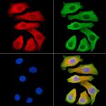 ND2 Polyclonal Antibody