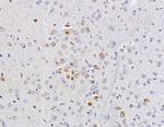 ND2 Antibody in Immunohistochemistry (Paraffin) (IHC (P))