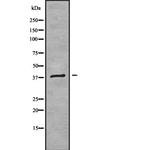 ND2 Antibody in Western Blot (WB)