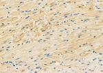MT-ND4L Polyclonal Antibody