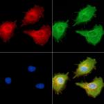 MT-ND6 Antibody in Immunocytochemistry (ICC/IF)