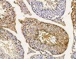 MT-ND6 Antibody in Immunohistochemistry (Paraffin) (IHC (P))