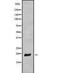 MT-ND6 Antibody in Western Blot (WB)