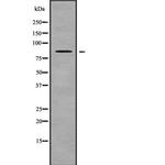 NPHP1 Antibody in Western Blot (WB)
