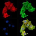 NBPF3 Polyclonal Antibody