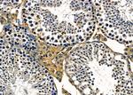 NBPF3 Antibody in Immunohistochemistry (Paraffin) (IHC (P))