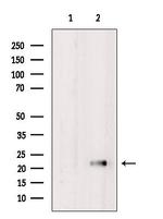 NCALD Antibody in Western Blot (WB)