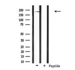 NAV1 Polyclonal Antibody