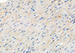 CHRNB3 Polyclonal Antibody
