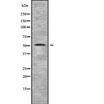 CHRNB3 Antibody in Western Blot (WB)