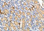 NTS Polyclonal Antibody