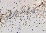 NTS Antibody in Immunohistochemistry (Paraffin) (IHC (P))