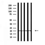 NTS Antibody in Western Blot (WB)