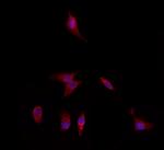 DFNA5 Antibody in Immunocytochemistry (ICC/IF)