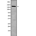 NUP155 Polyclonal Antibody