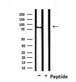 NOL11 Polyclonal Antibody
