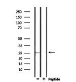Nop25 Polyclonal Antibody