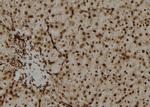 OAZ2 Polyclonal Antibody