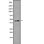 P2X1 Antibody in Western Blot (WB)
