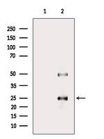 PRRX2 Antibody in Western Blot (WB)