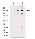 Palladin Antibody in Western Blot (WB)